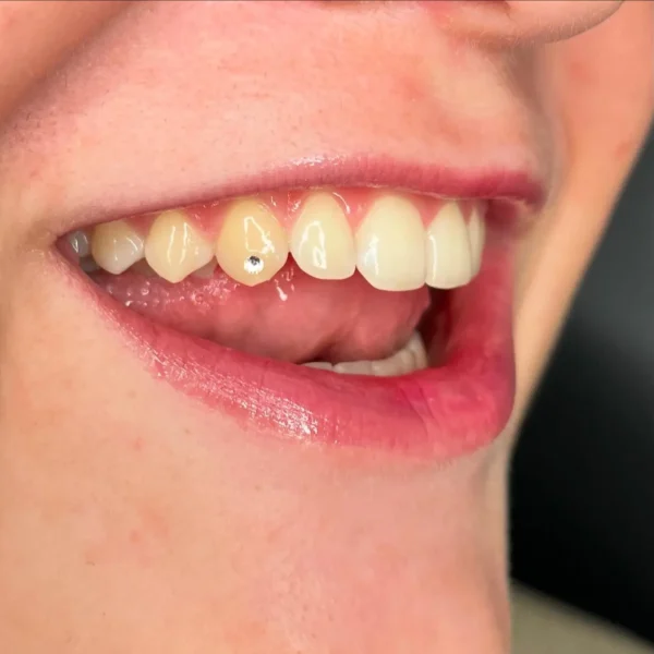 04074601-324F-4FDC-A056-E21562B137A7