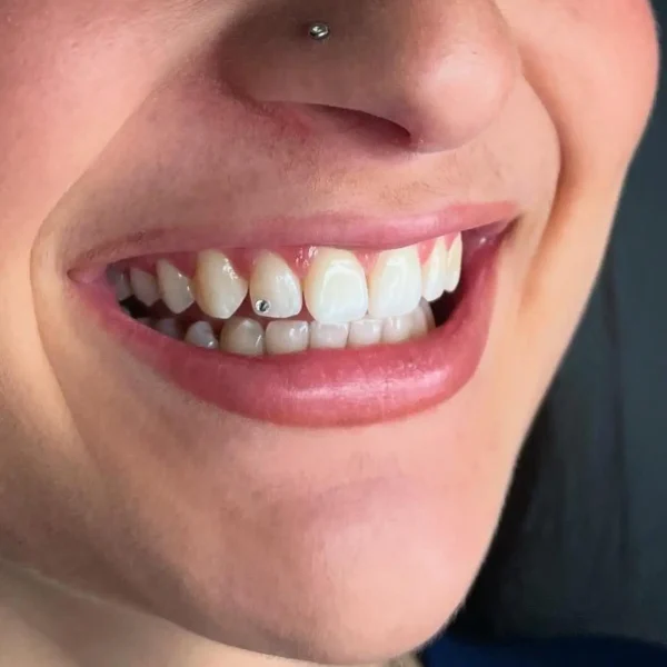 0D555FAC-437B-4270-950C-45ADAC8AD5C2