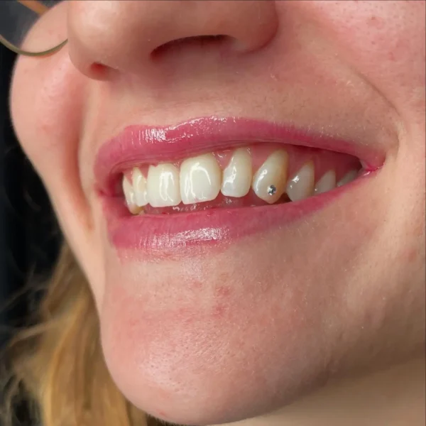 F46F738B-9315-4885-9FD0-15AE224CE4B8